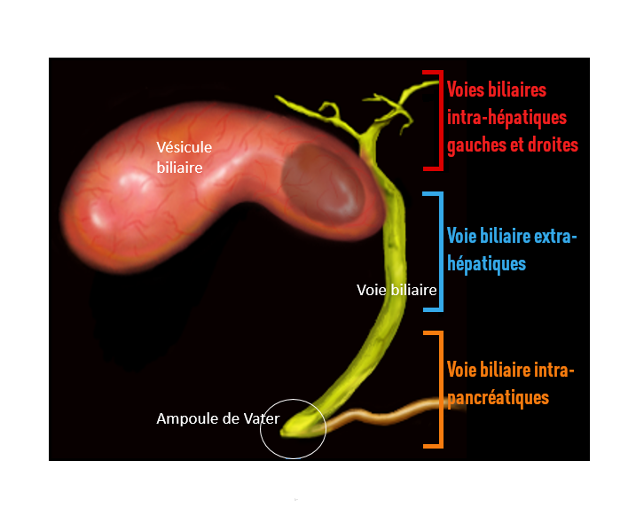 Quels Sont Les Signes D'un Cancer De La Vésicule Biliaire Cancer des voies biliaires | Institut Roi Albert II